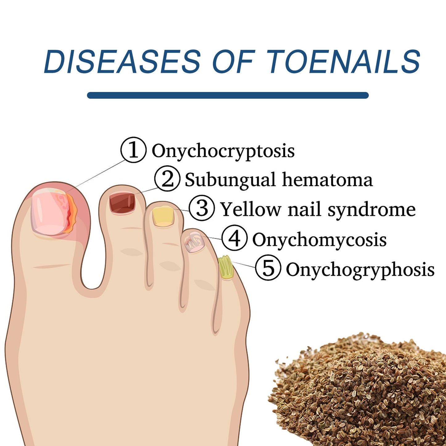 FungalCure™ - Renewal Fungal Nail Patches